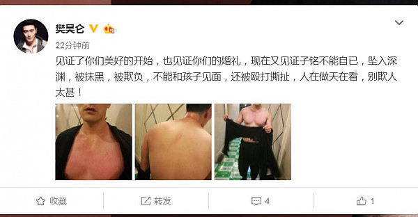 樊昊仑微博爆料赫子铭遭家暴 全身抓伤衣服被撕碎（组图） - 4