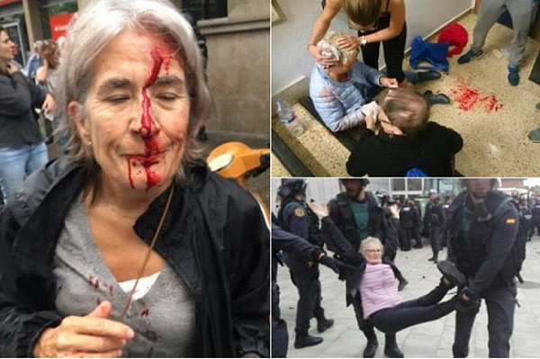 西班牙公投大乱！警察清场 打疯了 数百人溅血（组图/视频） - 1