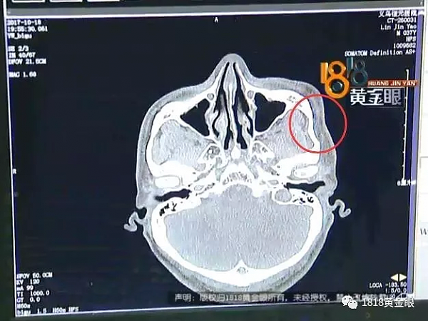 乘客记错老乡家地址被司机拖下车 脸被打凹进去了