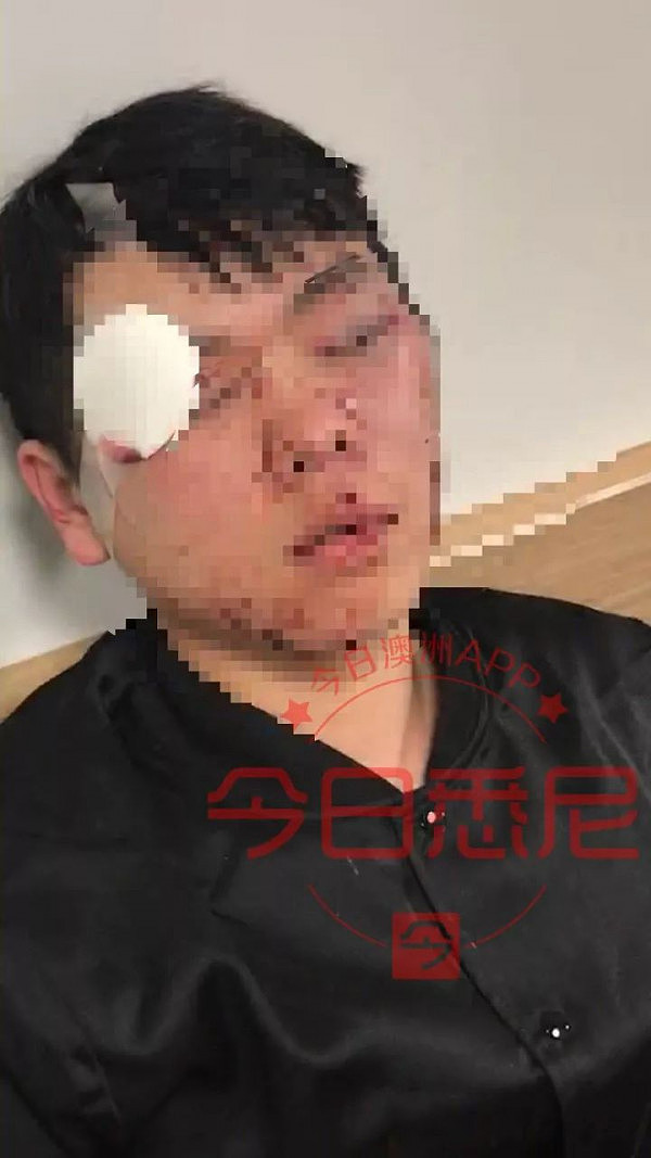 气愤！中国孩子在澳洲首都被“钉”在墙上打！眉骨开裂，满脸是血！一只眼睛短暂失明！目前警方与当地教育局已介入！华人需发声！ - 22