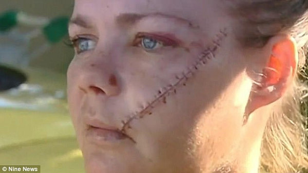 Ingrid Brown (above) relived the terrifying ordeal when a man slashed her face with an axe in an unprovoked attack