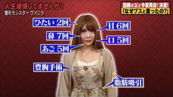 只因为爸爸的一句吐槽，这个日本女生整容了100次，现在成了这样…（组图） - 13