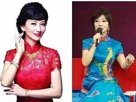 为了爱美，坚持30年不吃晚饭的她，如今癌症进手术室都要化完妆！