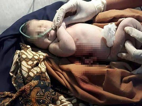 印尼女大学生厕所产女婴 企图用剪刀杀女自己却先死了