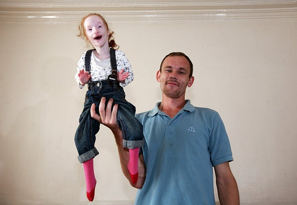 英国0.6米“洋娃娃”：受尽嘲讽，医生说活不过20岁，却在父母呵护下活成公主（组图） - 5