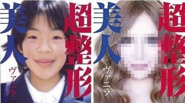 日本丑女遭歧视，花1千多万疯狂整容50次，终于成了“芭比娃娃”！ - 2