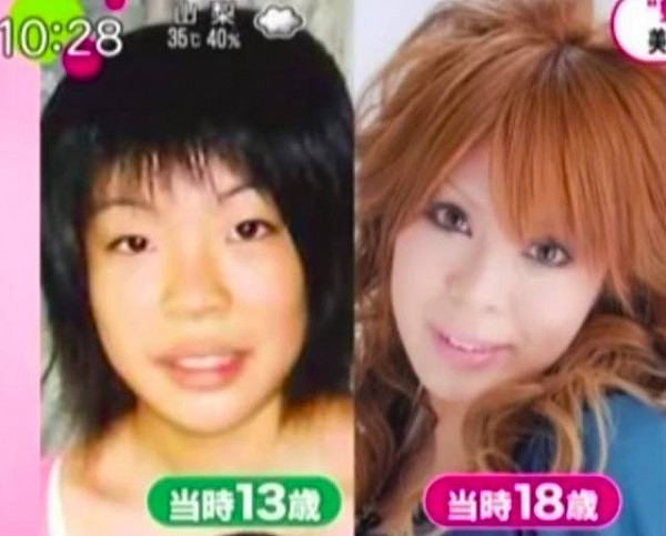 日本丑女遭歧视，花1千多万疯狂整容50次，终于成了“芭比娃娃”！ - 9