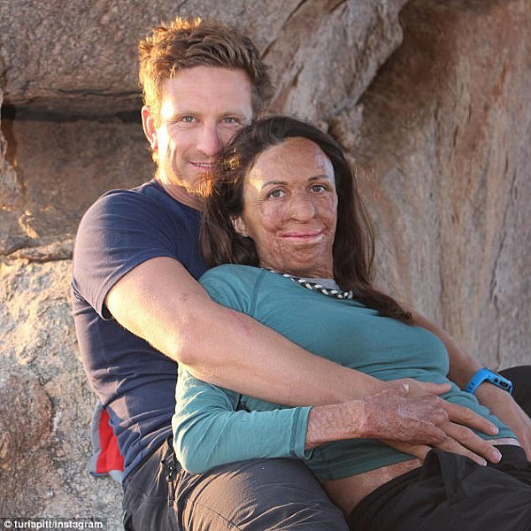 Turia Pitt and her partner, Michael Hoskin, are waiting for the arrival of their baby boy in December