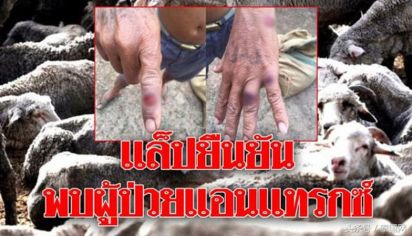 泰国确诊1例炭疽病例，因食用缅甸走私羊肉被感染！