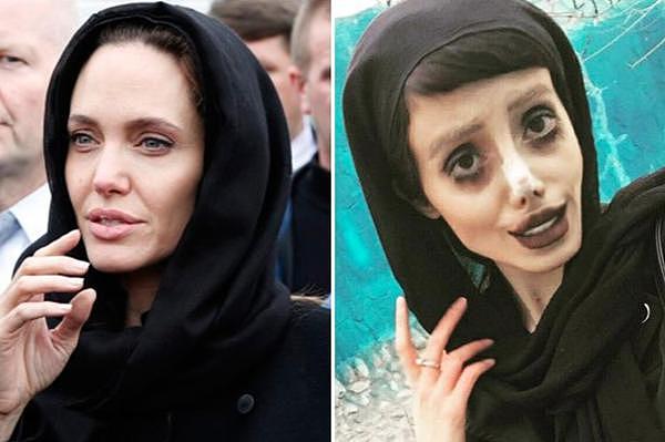 伊朗女孩为变安吉丽娜·朱莉整容50次 网友：像僵尸新娘