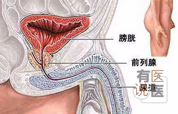 吸毒男子把锁头从尿道塞进膀胱 医生拍片后吓一跳