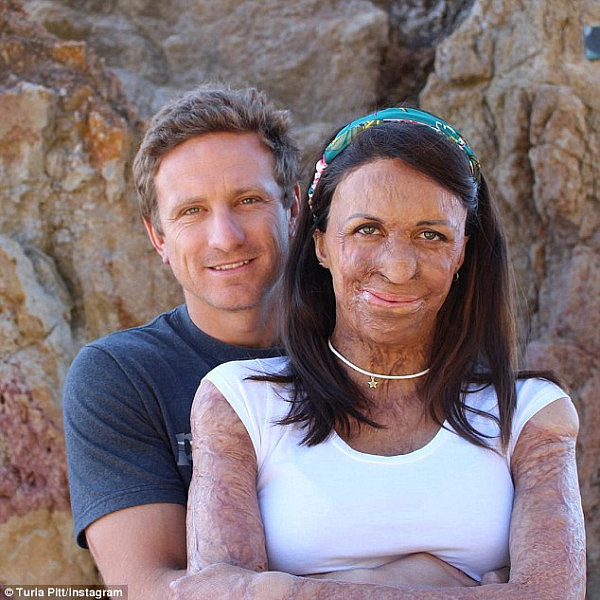 46D4BE0B00000578-5131253-Burns_survivor_Turia_Pitt_and_her_fiance_Michael_Hoskin_have_wel-a-1_1512692143191.jpg,0