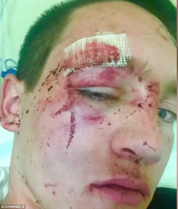 Matthew St Vincent (pictured) was assaulted after he was beaten by a man passing him by in a taxi