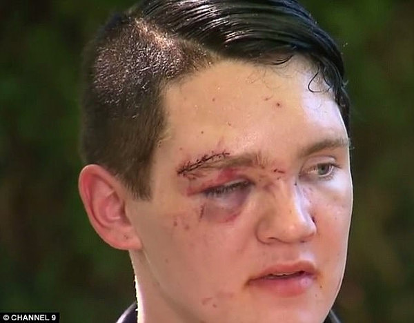 The 18-year-old was visiting a friend in Marrickville when he was viciously attacked