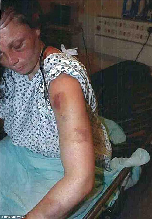 英国女子遭遇“最残忍”家暴 被逼裸体站着睡觉吃死去养母照片（组图） - 1