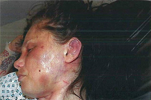英国女子遭遇“最残忍”家暴 被逼裸体站着睡觉吃死去养母照片（组图） - 2