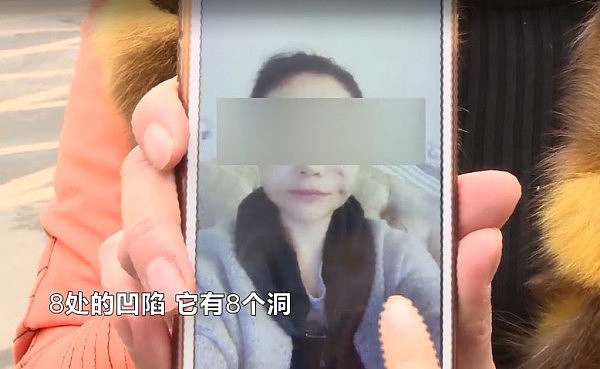 女子脸部整容整出八个坑 工作人员:想要美先变鬼