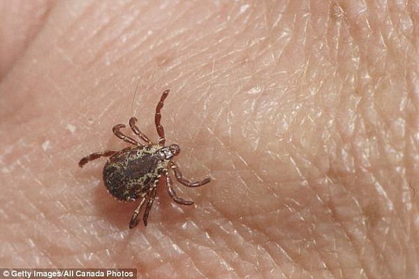 482072CC00000578-5267595-Lyme_Disease_can_be_contracted_by_ticks_with_the_bacteria_Borrel-a-45_1515940112466.jpg,0