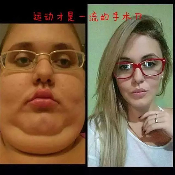 图片慎入！BBC解剖了一个200斤女子，看完你会用生命去减肥！ - 21