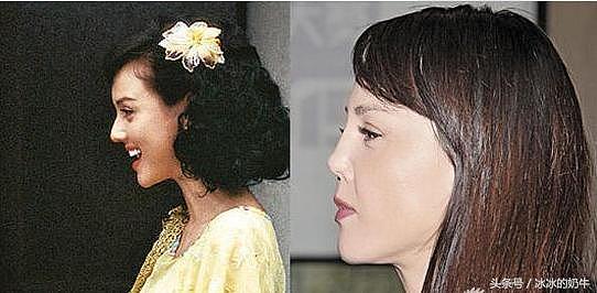 香港惊艳女演员，搭档多名一线明星拍戏，多次整容失败退出演艺圈