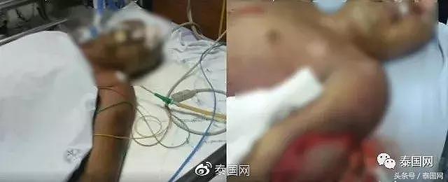 冤死一年的泰国军人尸体不腐，坚硬如石，头发眉毛胡须还在生长？