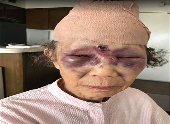 81岁亚裔老奶奶在洛杉矶街头无故遭殴打，凶手打人的理由让人气愤！ - 1