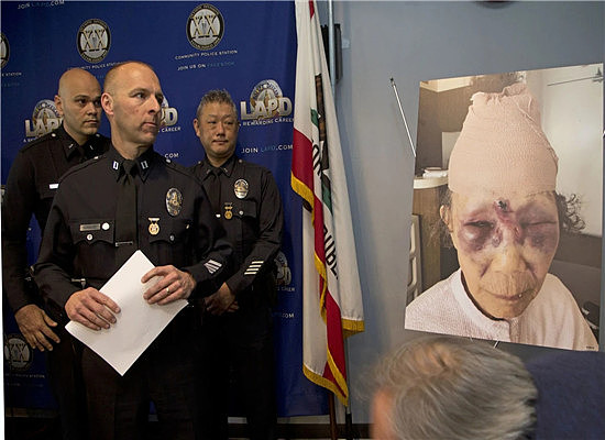 81岁亚裔老奶奶在洛杉矶街头无故遭殴打，凶手打人的理由让人气愤！ - 2