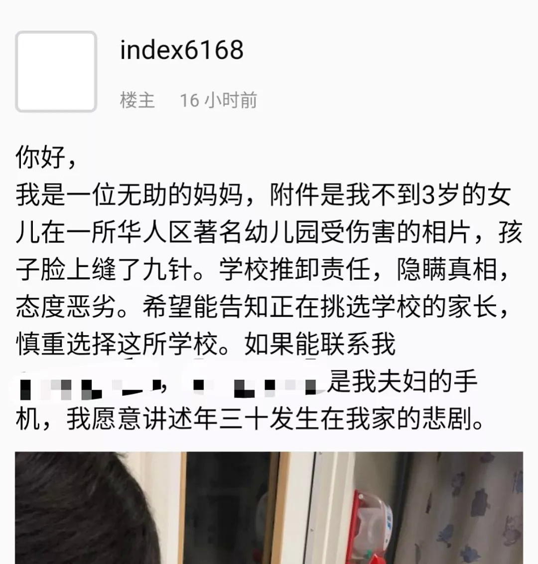 华人2岁小女孩脸上扎了血窟窿，学校竟然这样做！（组图） - 1