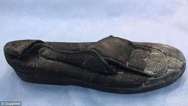 The slipper (pictured) was eventually removed through a coeliotomy and gastrotomy procedure where the snake's stomach was closed in two layers