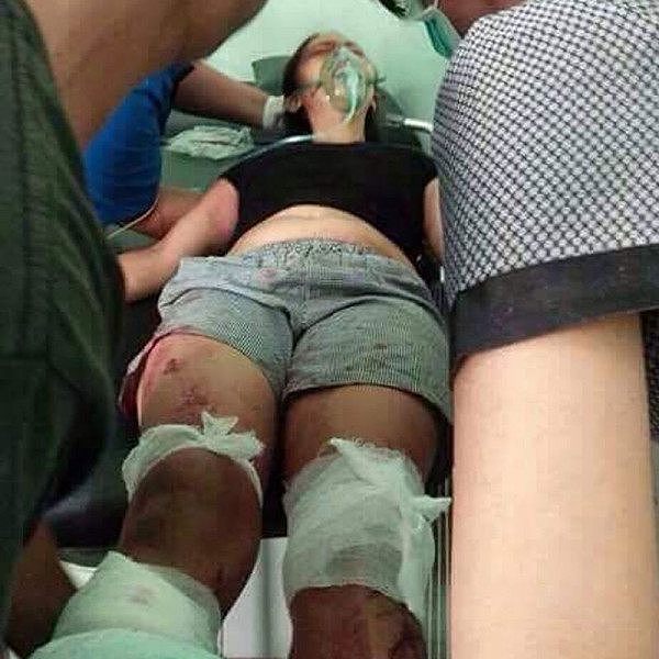 亚裔女佣被砍断双腿，只因丈夫疑其出轨！澳洲雇主热心为其筹款 - 5