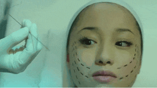 中国女人热捧的瘦脸针到底多神奇？BBC揭秘幕后的残酷真相 - 2