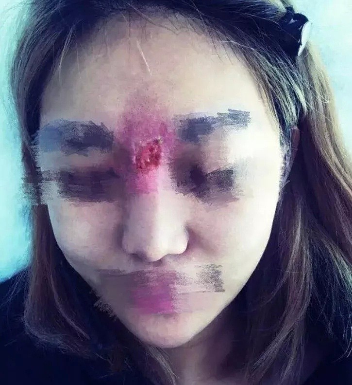 中国女人热捧的瘦脸针到底多神奇？BBC揭秘幕后的残酷真相 - 29