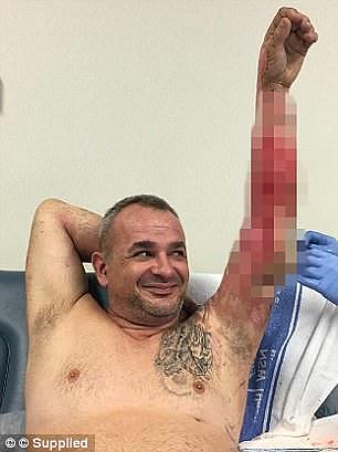 'Mark' was hosting a birthday party at his home in western Sydney on March 17 when he decided to throw an explosive batch of chemicals into a roaring barbecue