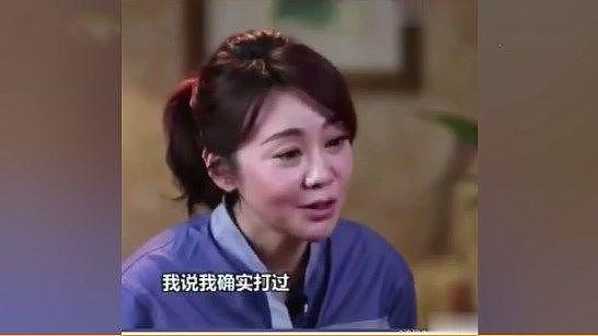 “佟掌柜”闫妮大方承认整容：“为了变美，打打针其实也没什么”