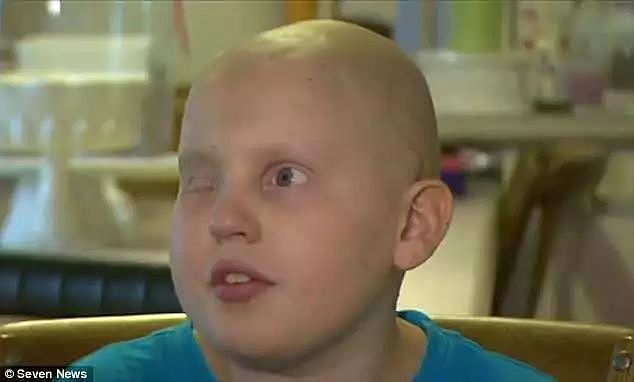 澳洲小孩三度患癌导致失明毁容腿烂掉，他居然对妈妈说了这番话！ - 6