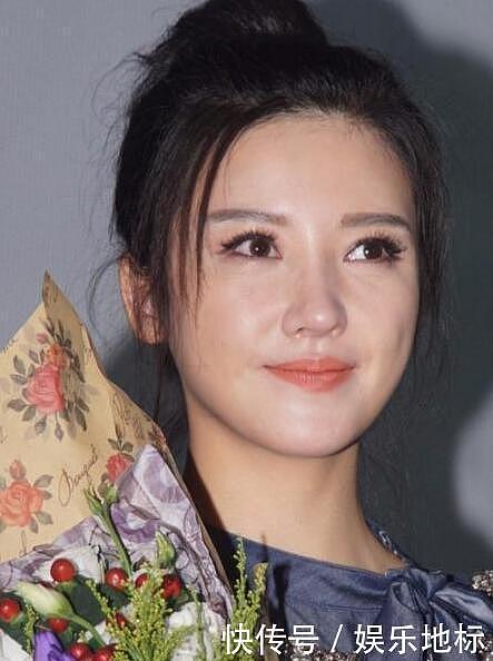 惨不忍睹，又一个女明星整容失败！网友：这不是我的女神！