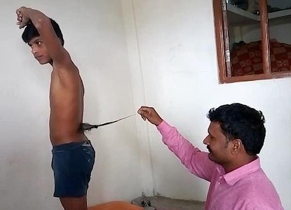 印度13岁男孩长“尾巴”被奉为猴神转世