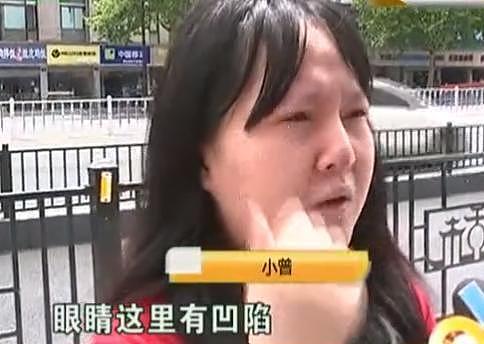 女子垫鼻整容失败，硅胶都露出来了，网友：还挺别致的 - 3