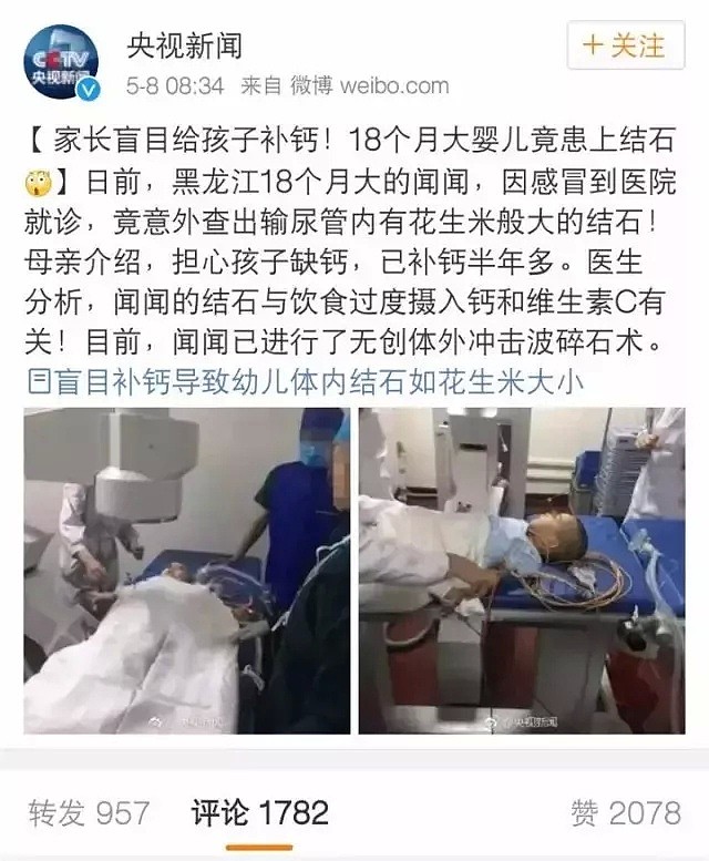 补钙半年，18个月宝宝惨得肾结石！只因家长少做了“这一步”... - 3