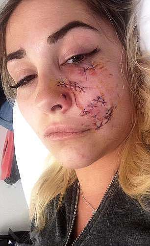恐怖！美女模特在澳惨遭恶犬袭击 半张脸被咬烂！（组图） - 1