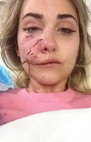 恐怖！美女模特在澳惨遭恶犬袭击 半张脸被咬烂！（组图） - 2