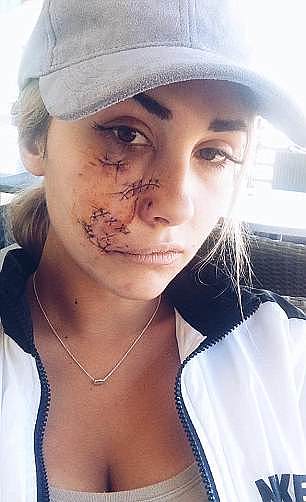 恐怖！美女模特在澳惨遭恶犬袭击 半张脸被咬烂！（组图） - 3