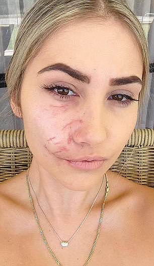 恐怖！美女模特在澳惨遭恶犬袭击 半张脸被咬烂！（组图） - 7