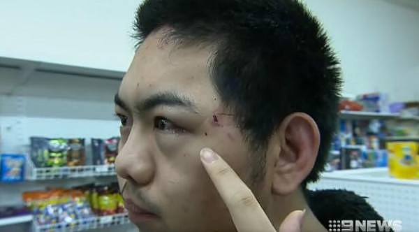 “我以为他要杀了我！” 澳洲华人店遭持械打劫，歹徒疯狂挥棍！华人店员奋起反击擒匪，多处受伤！（视频/组图） - 5