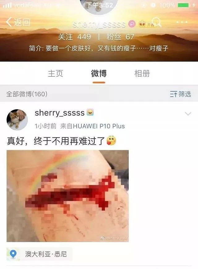 澳大学中国女留学生微博直播割腕，却被自称