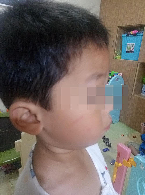 上海一幼儿园再爆虐童事件，多名幼儿面部被划伤，涉事老师被刑拘园长被免职（视频/组图） - 4