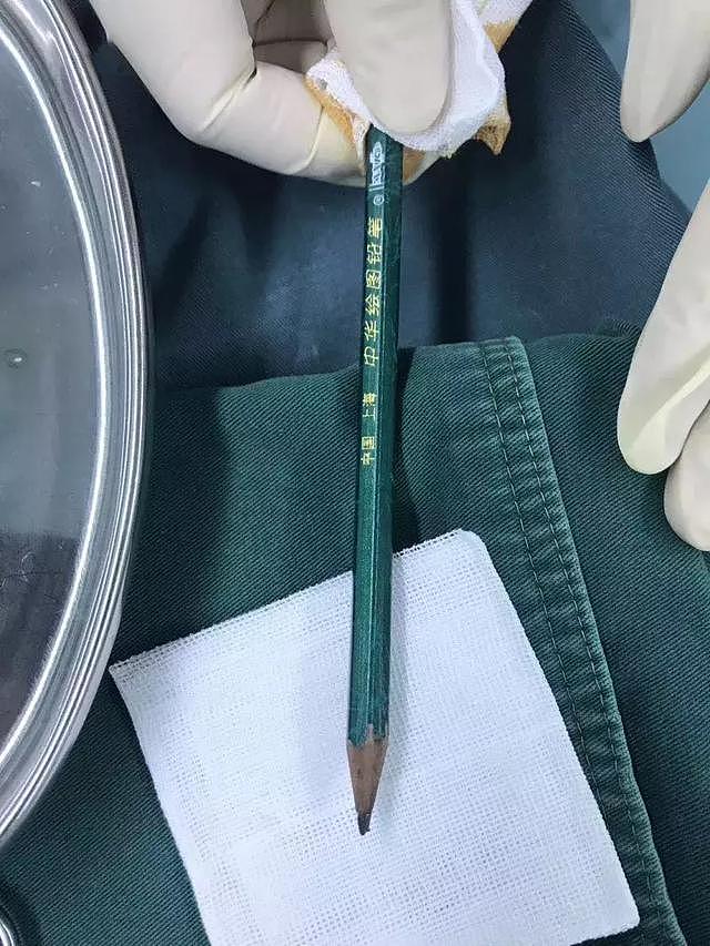这根插进臀部的铅笔，足足15厘米长！这样的恶作剧实在太可怕了！