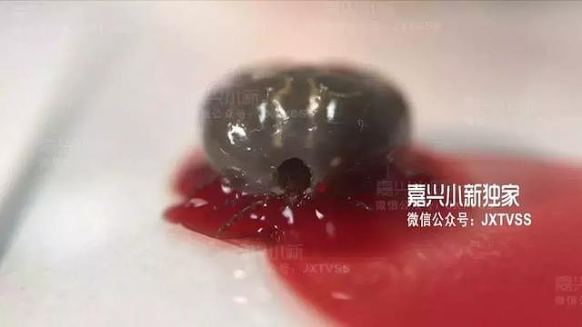 5岁男孩幼儿园放学后不停挠头，妈妈一看头上黑黑的……吓坏了！