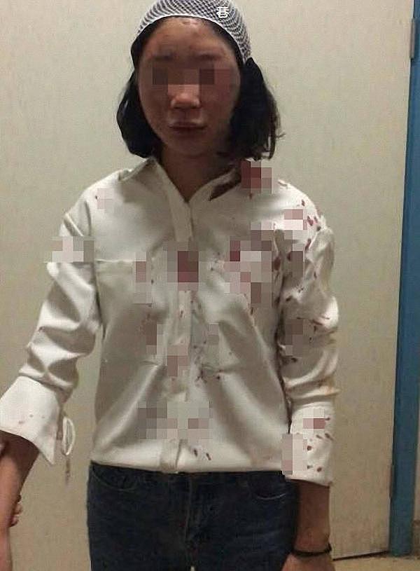 女大学生昆明旅游遭殴打 嫌犯被公诉:拉客不成泄愤