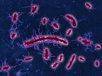 只是因为自己不喜欢洗手，她害死了一个又一个的人...（组图） - 15